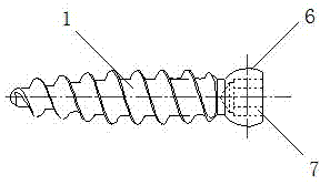 Distal tibiofibular syndesmosis hinge type flexible fixing device