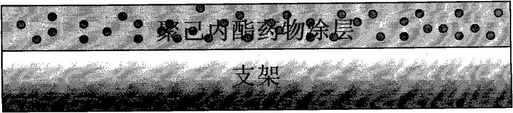 Bracket with drug temperature-sensitive controlled-release function and application thereof