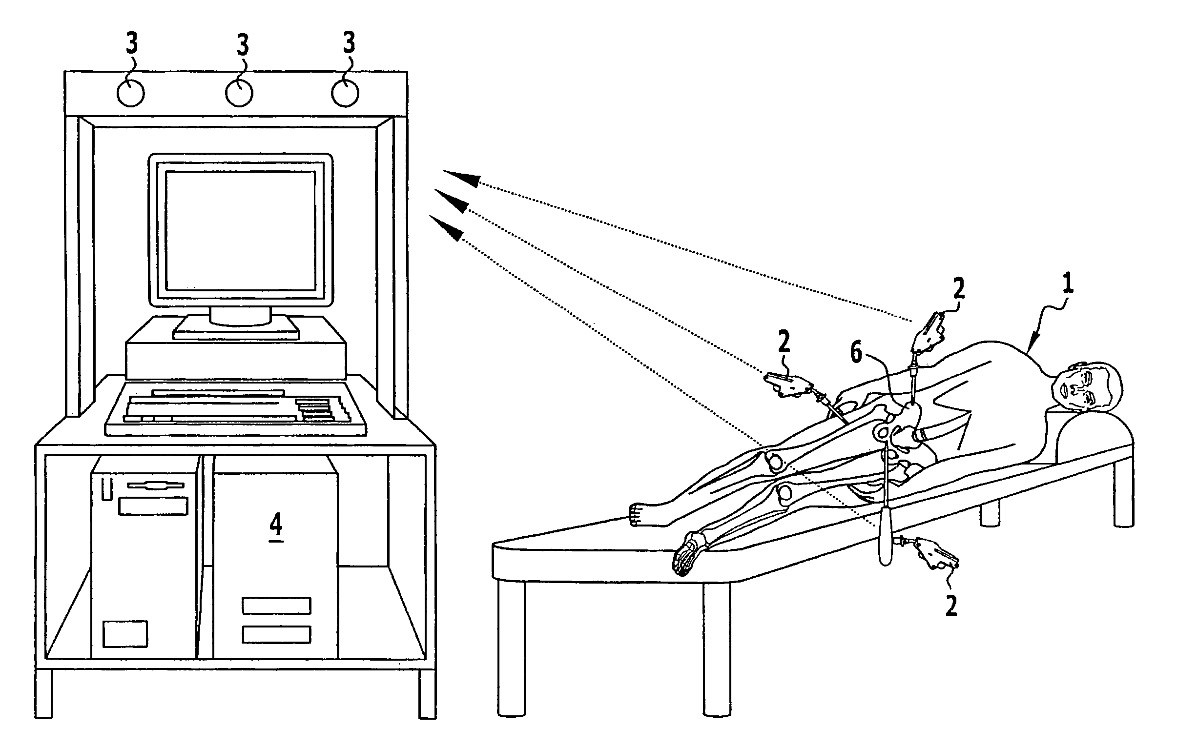 Method and surgical navigation system for creating a recess to receive an acetabulum