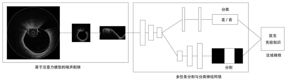 Cardiovascular vulnerable plaque recognition method and system based on attention model and multi-task neural network