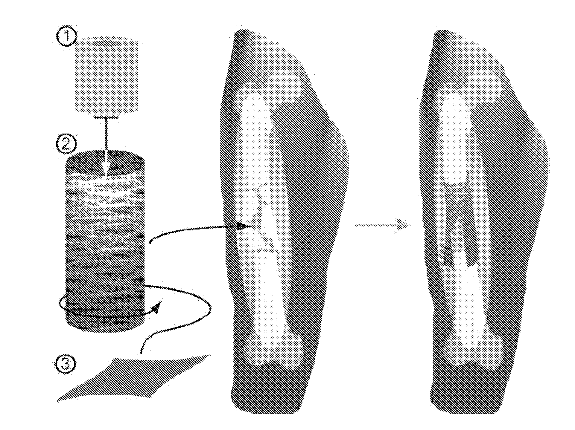 Shape-memory-actuated materials for accelerated healing of orthopedic injuries