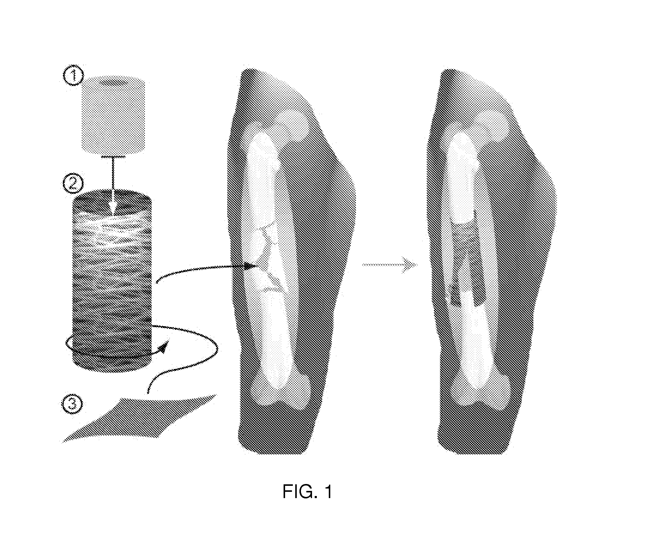 Shape-memory-actuated materials for accelerated healing of orthopedic injuries