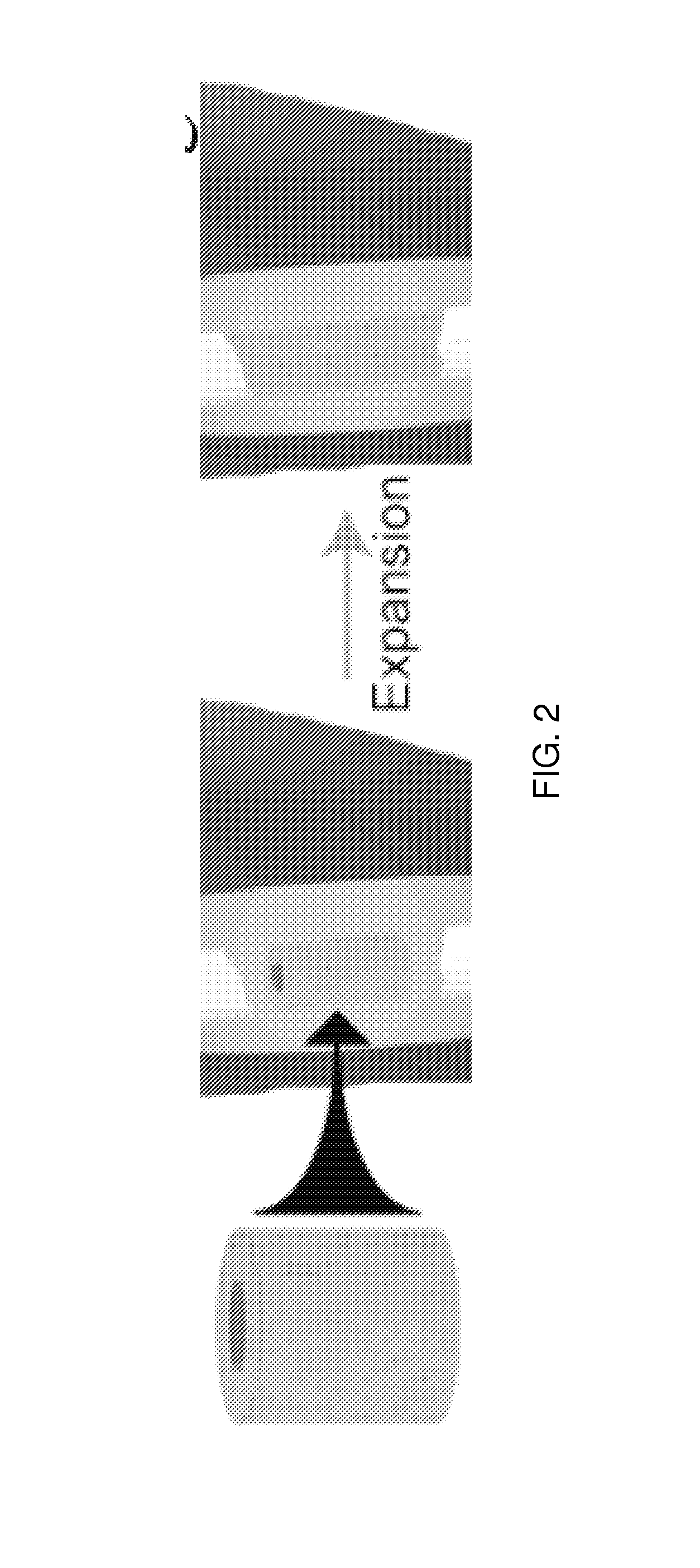 Shape-memory-actuated materials for accelerated healing of orthopedic injuries