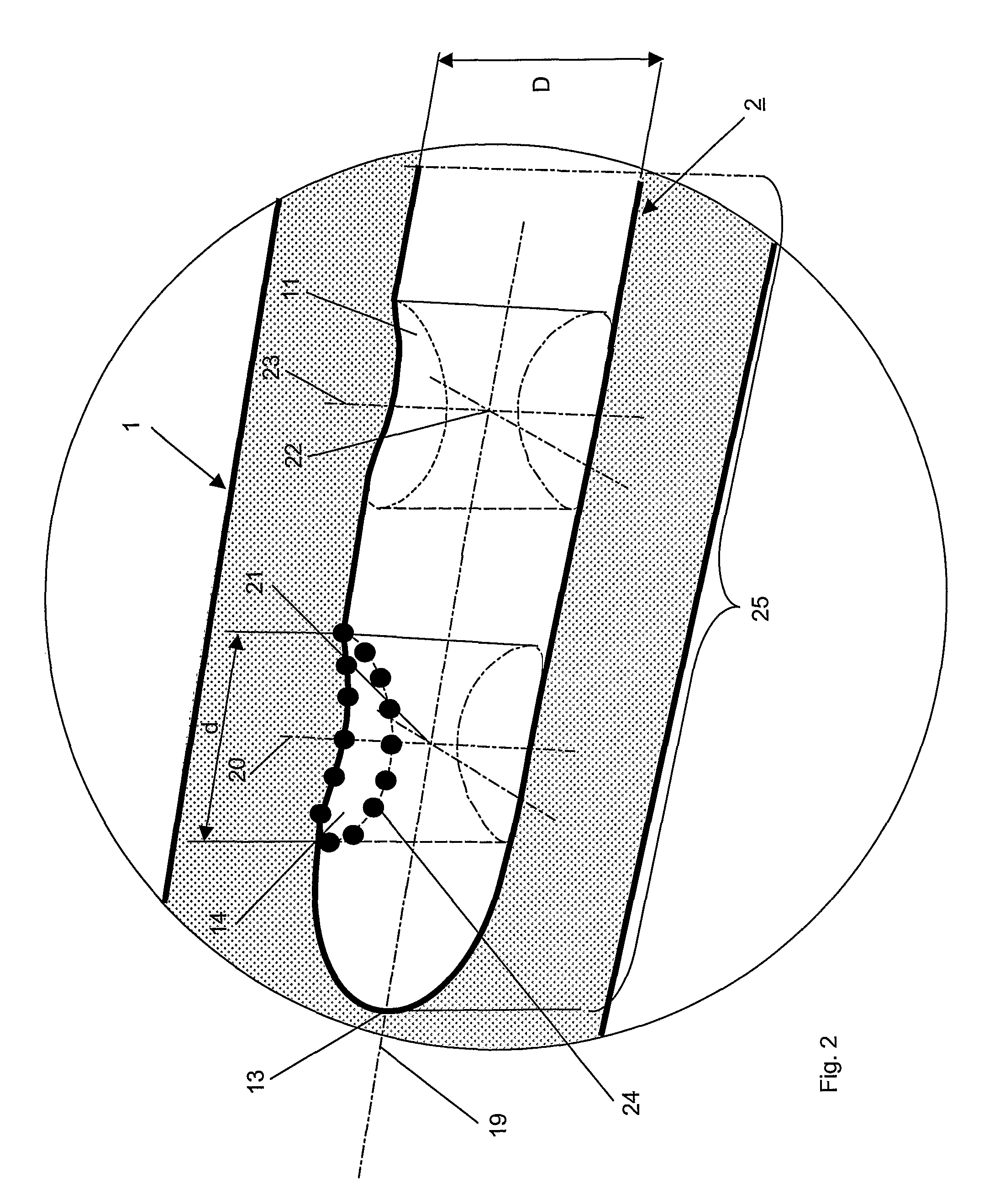 Method and Device for Computer Assisted Distal Locking of Intramedullary Nails