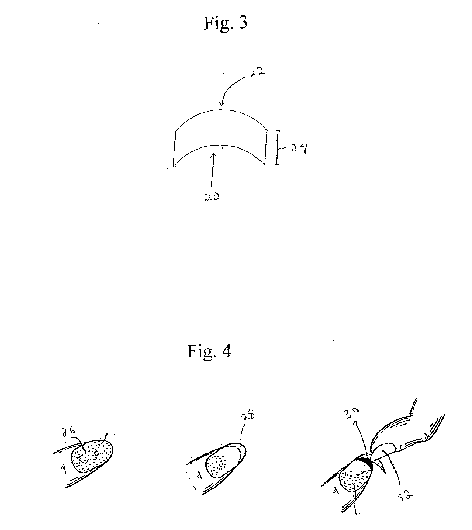 Method and Product for Attaining a French Manicure Using a Dry Nail Applique