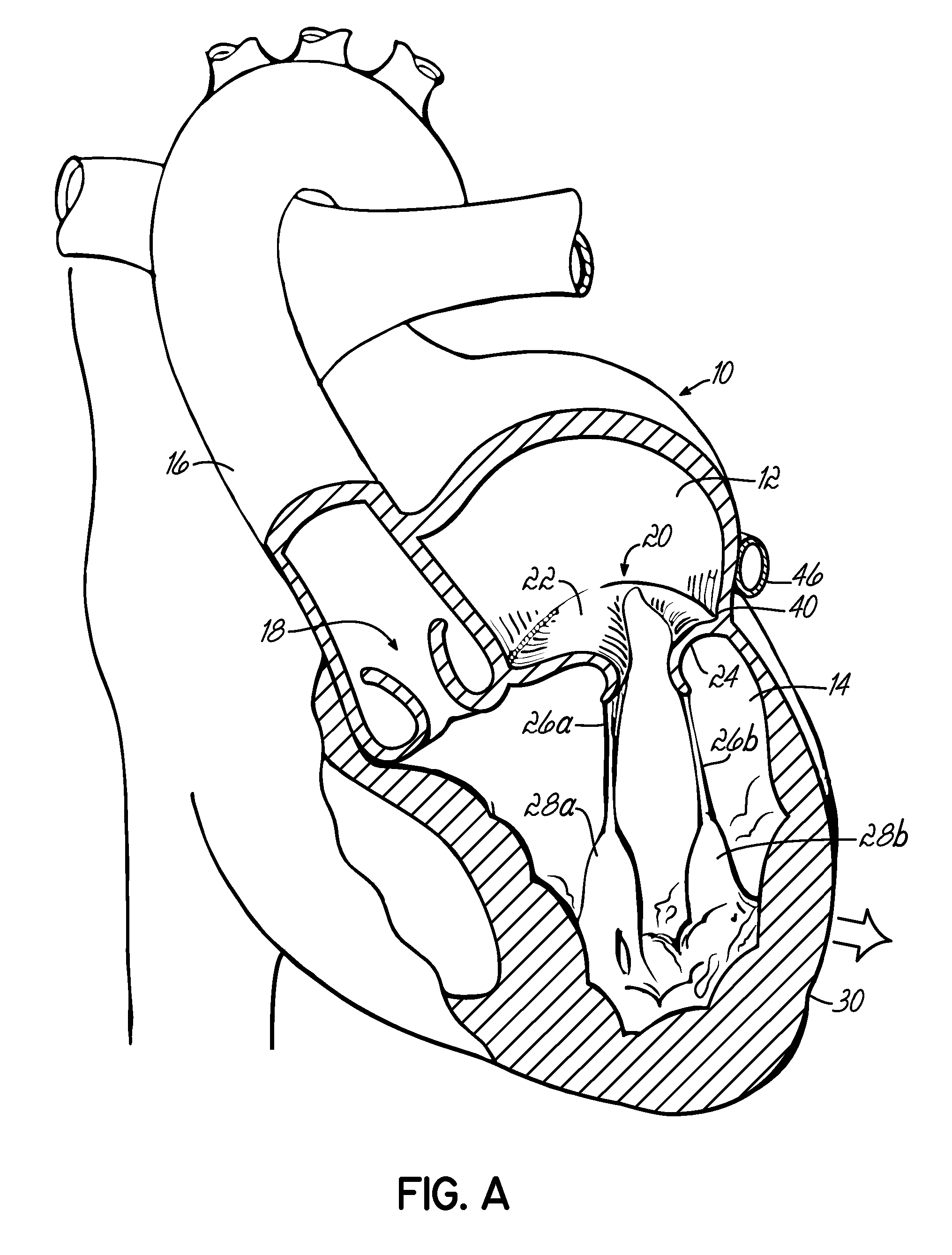 Tissue fastening systems and methods