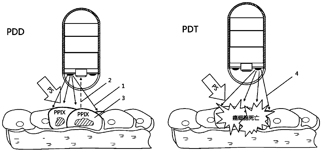 Photodynamic diagnosis and therapy integrated alimentary canal capsule endoscopy