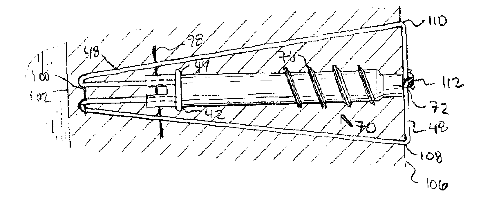 Medical device for repair of tissue and method for implantation and fixation