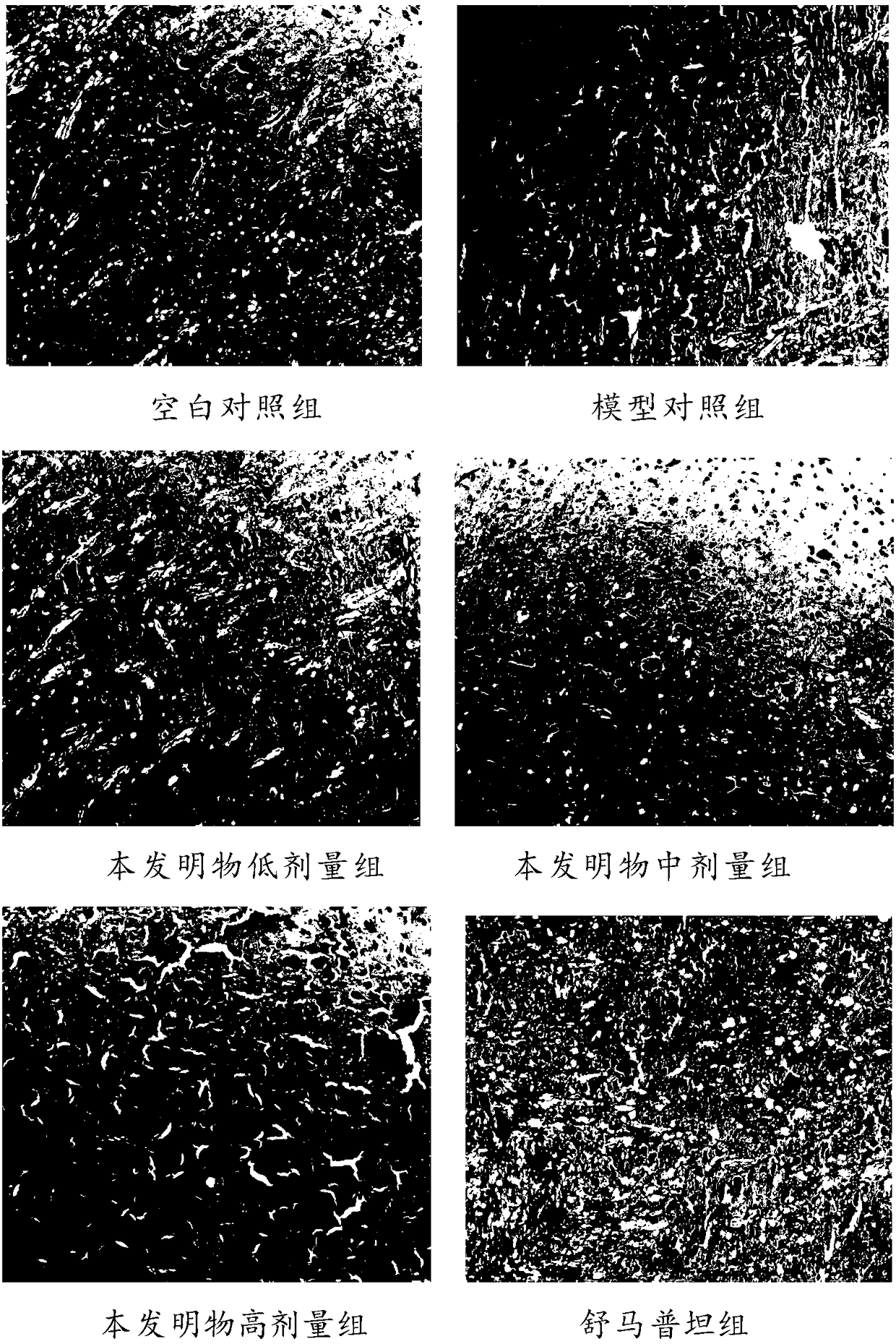 Traditional Chinese medicinal composition for treating migraine as well as preparation method and traditional Chinese medicinal preparation thereof