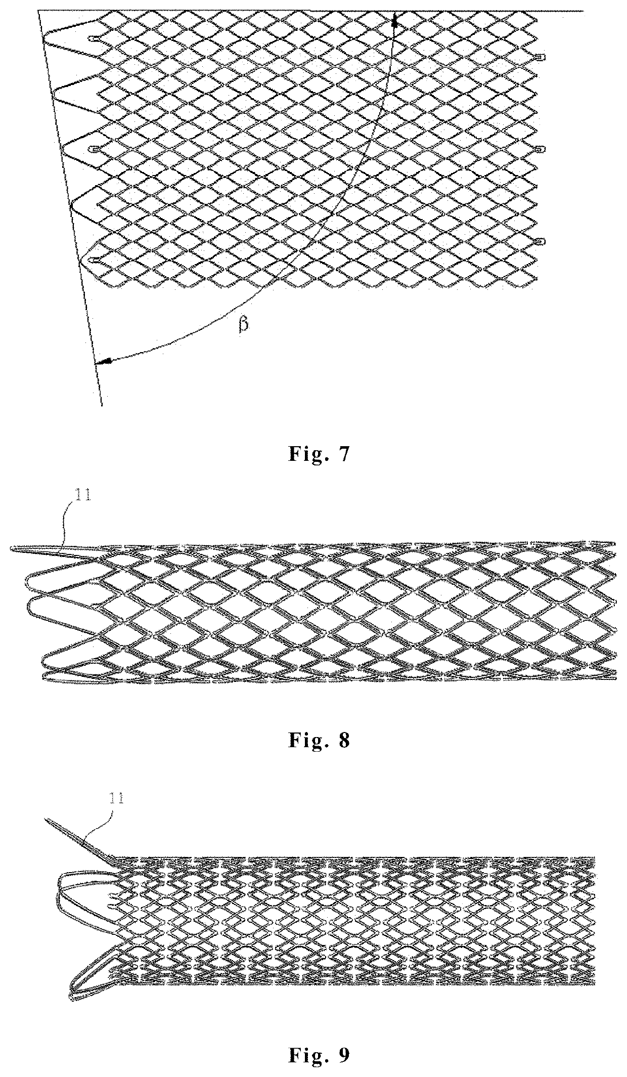 Intravascular stent, preparation method and use thereof