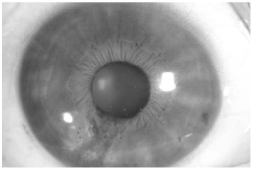 Kit and method for detecting EBV infection in trace biological sample of eye