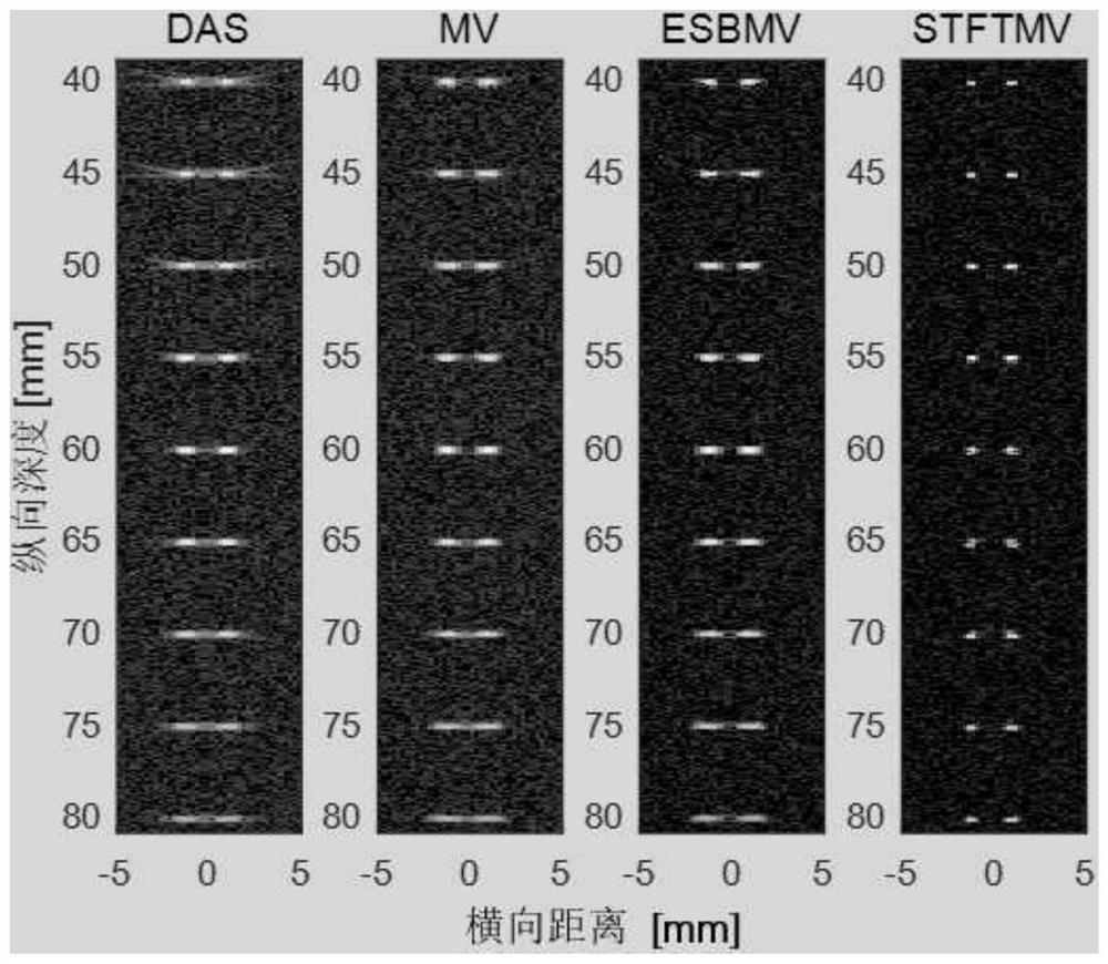 A High Resolution Minimum Variance Ultrasound Imaging Method Based on Frequency Domain Segmentation