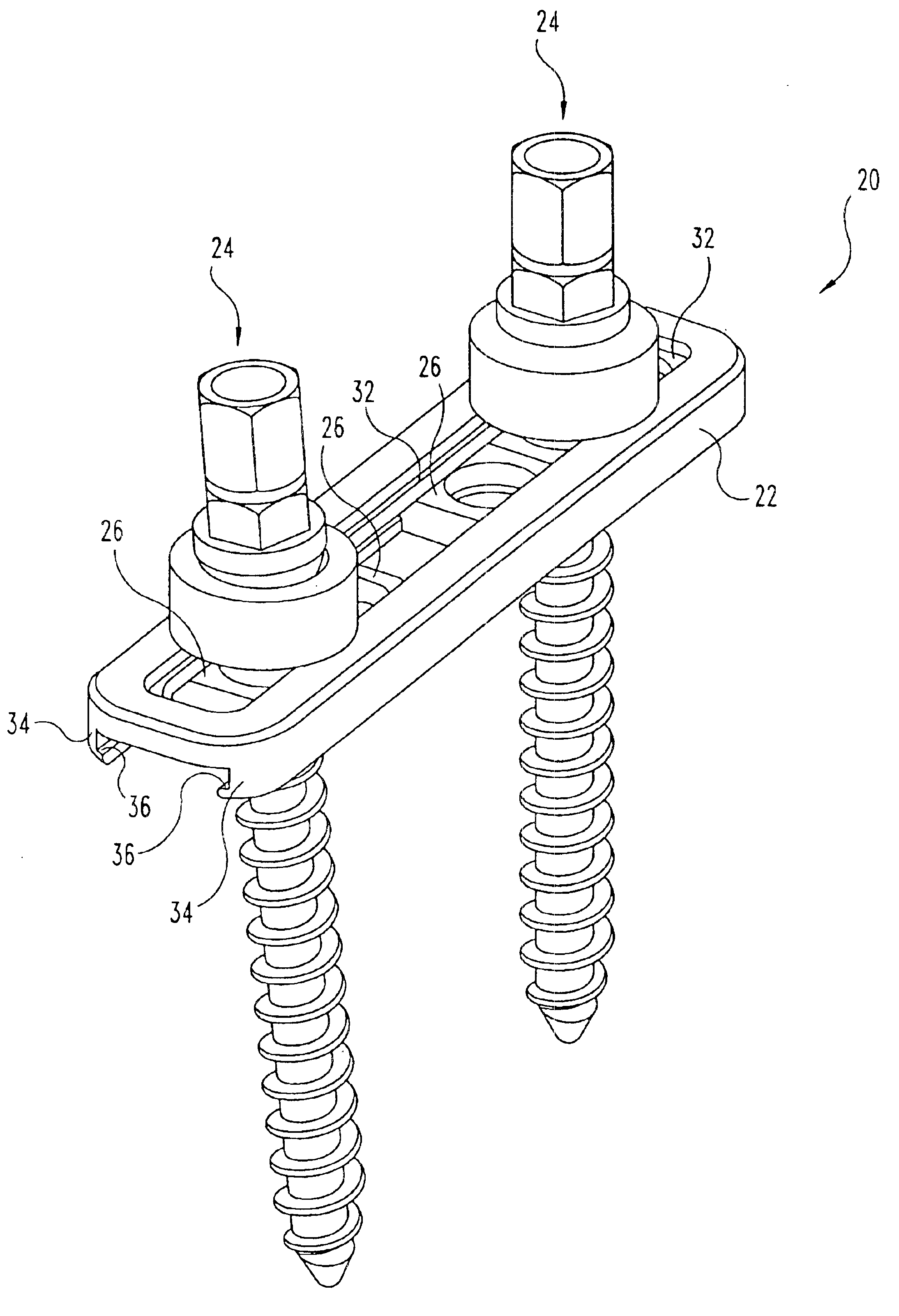 Multi-axial bone anchor system