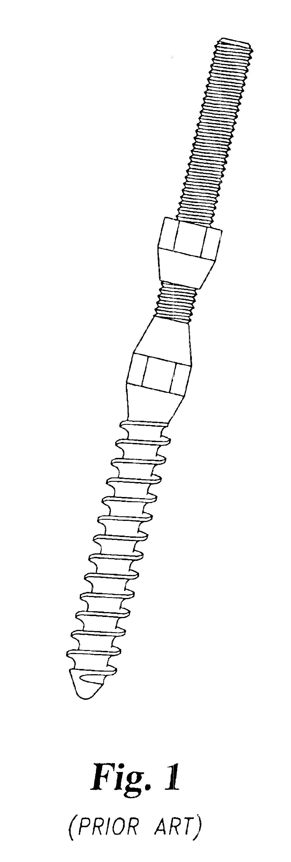 Multi-axial bone anchor system