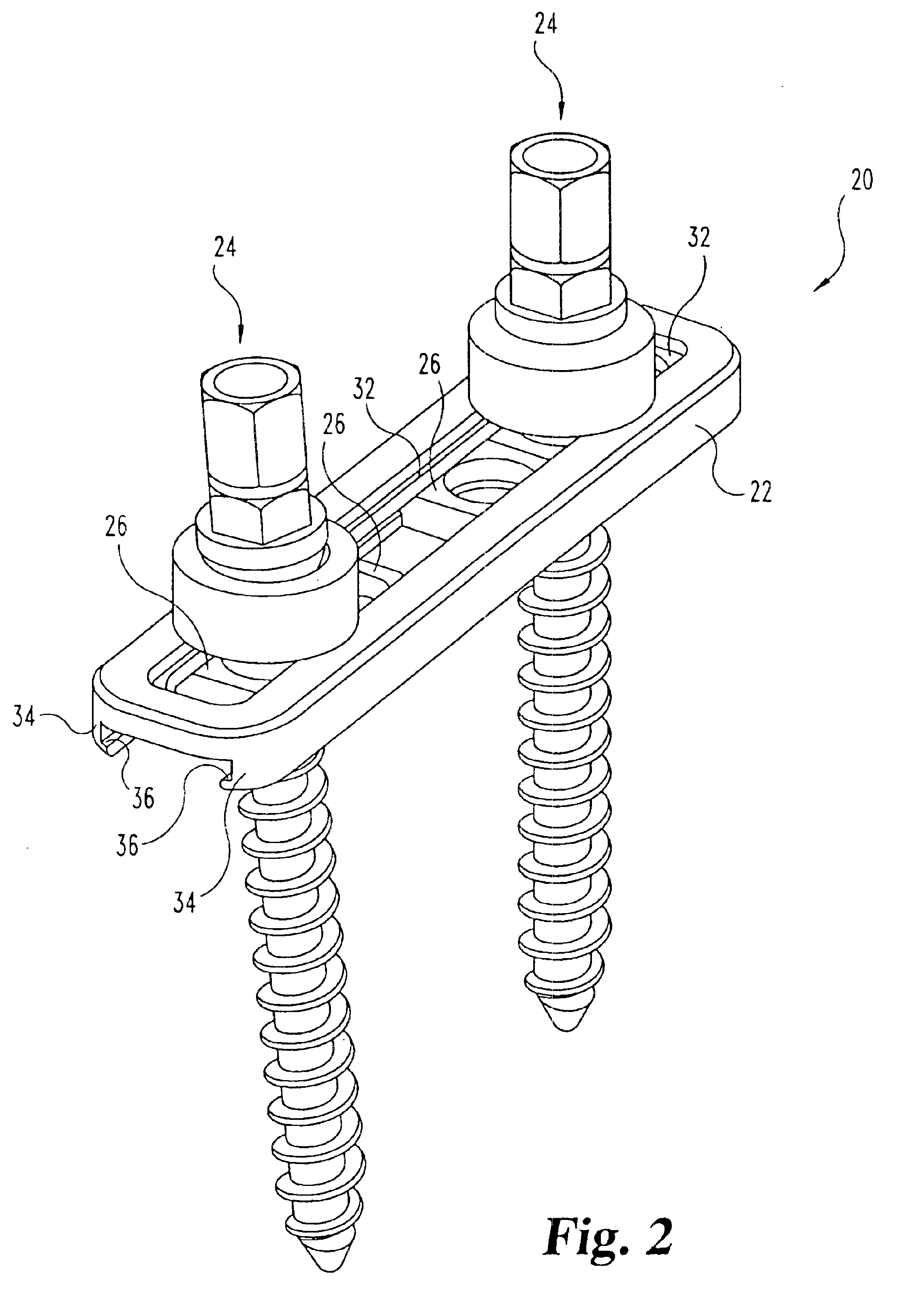 Multi-axial bone anchor system