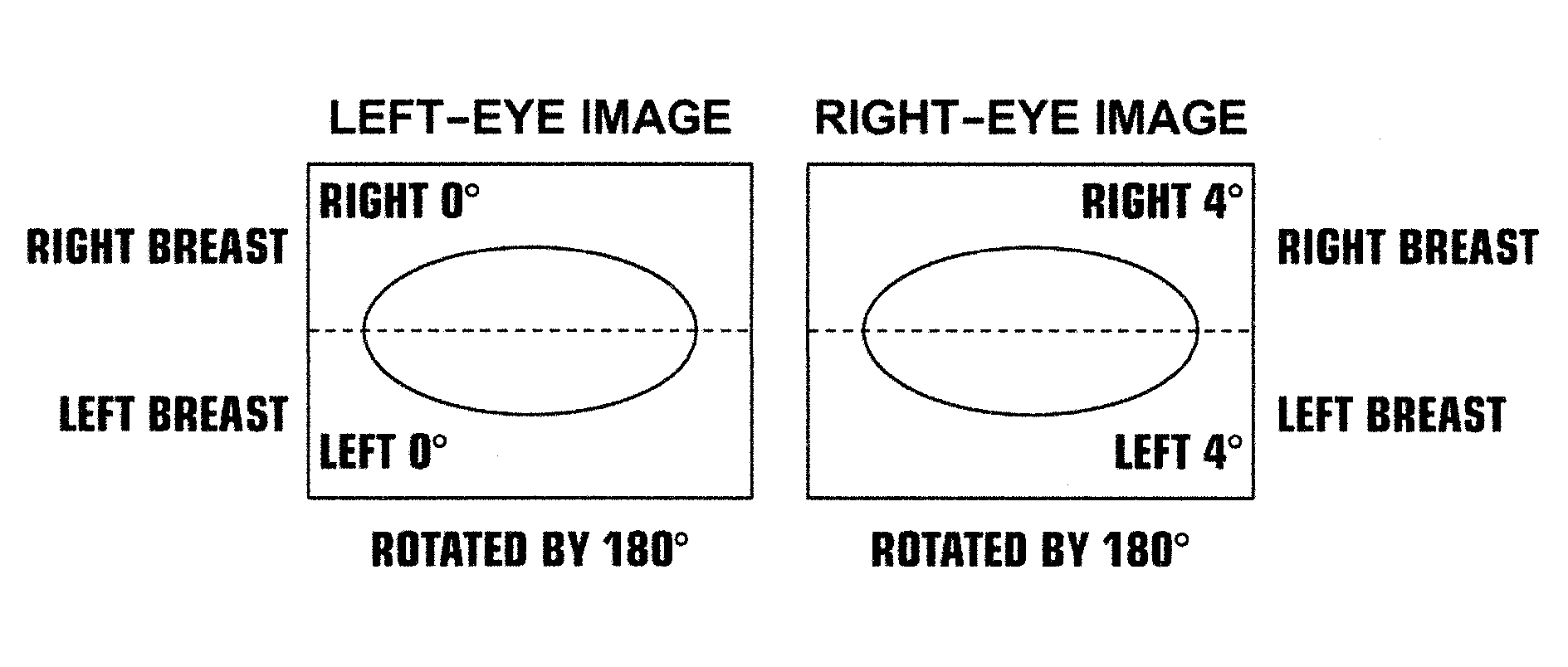 Radiological breast image display method, radiological breast image display apparatus, and program