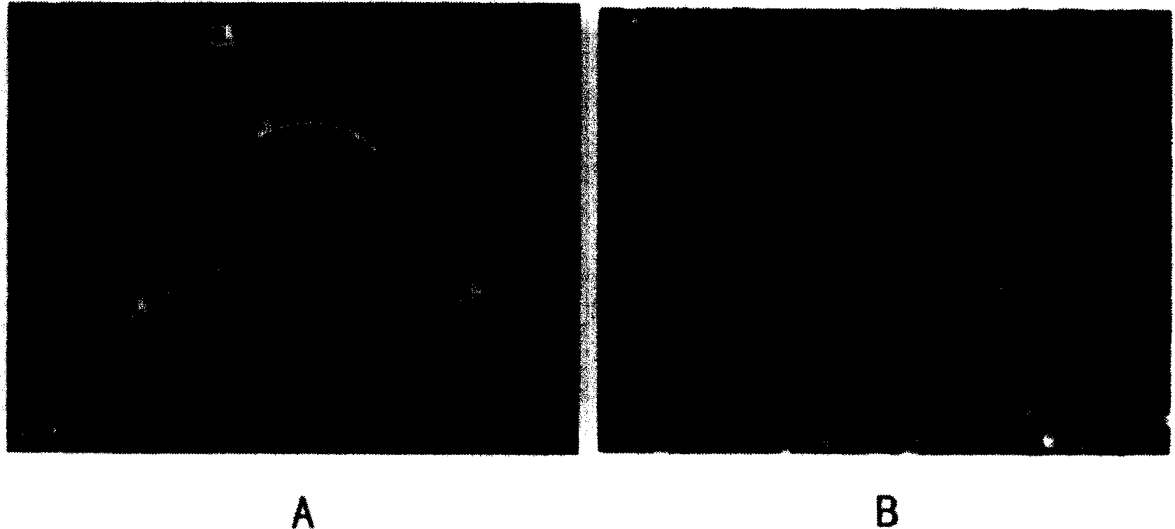 Capillary electrophoresis multi dimension device