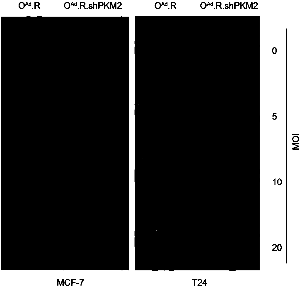 Cancer-targeting recombinant oncolytic gene-adenovirus and construction method and application thereof