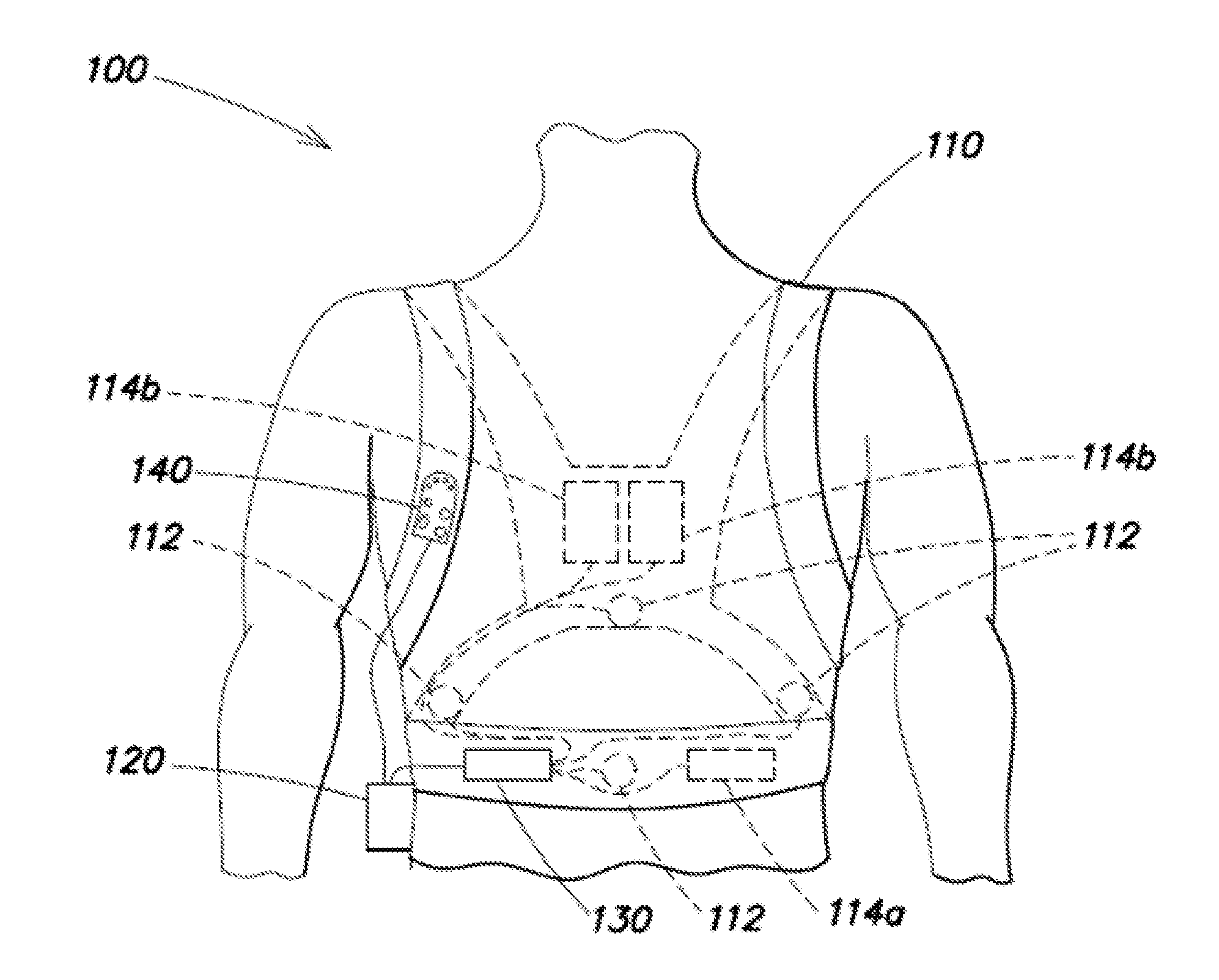 Method of detecting signal clipping in a wearable ambulatory medical device