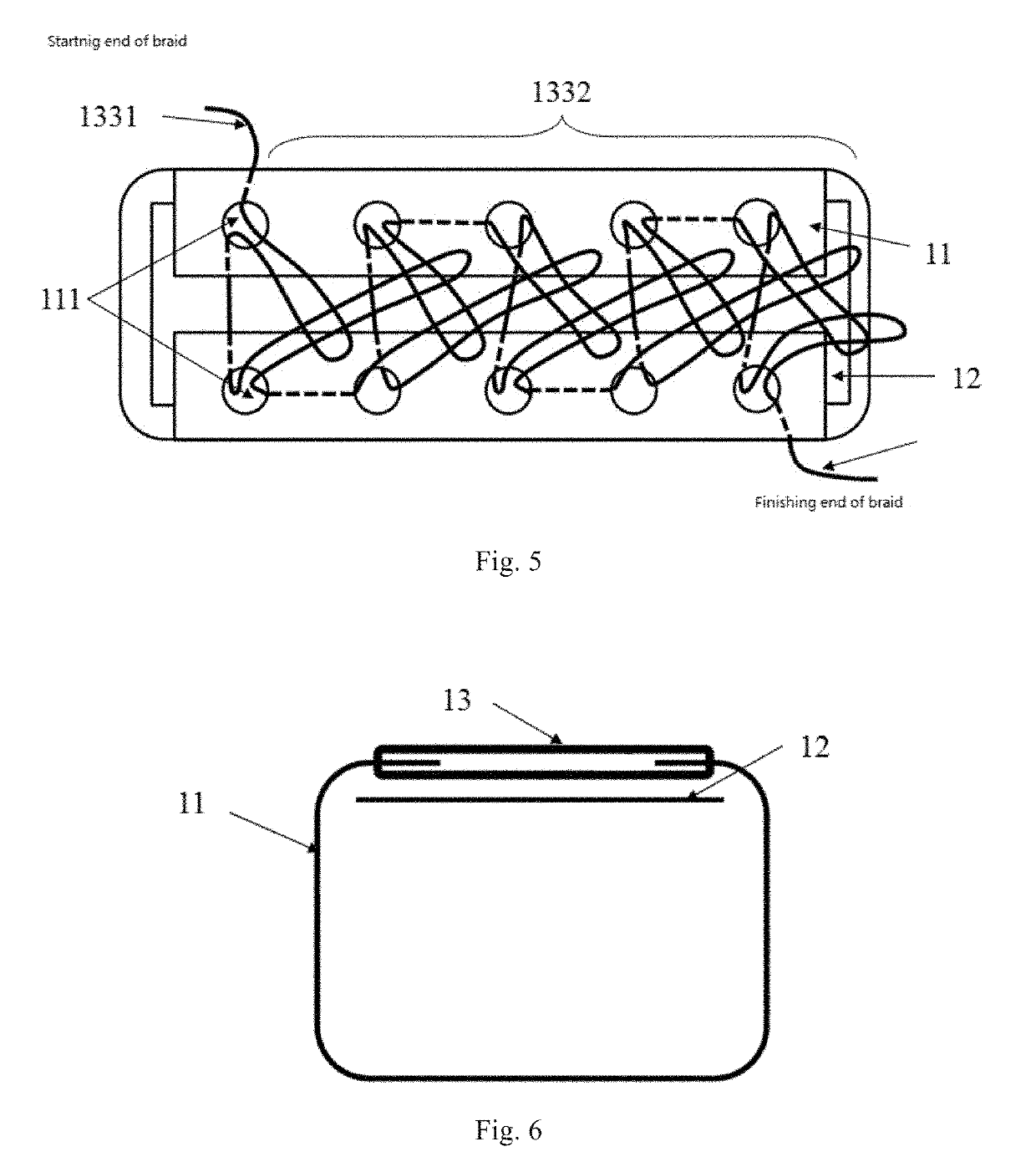 Anastomotic/occlusion reinforcing and repairing composite member as well as preparation and application method thereof