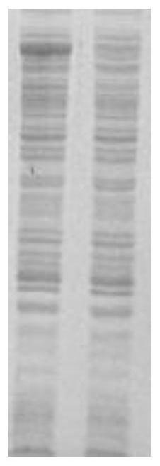 Treponema pallidum recombinant chimeric antigen and its preparation method and use