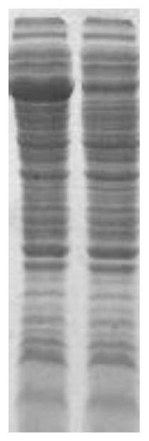 Treponema pallidum recombinant chimeric antigen and its preparation method and use