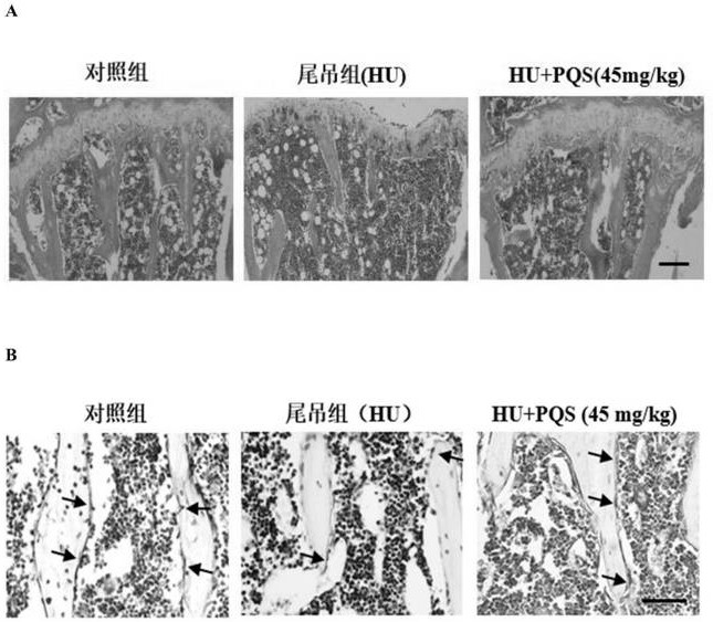 Application of total saponins of American ginseng stems and leaves in the preparation of a composition for combating bone loss caused by weightlessness