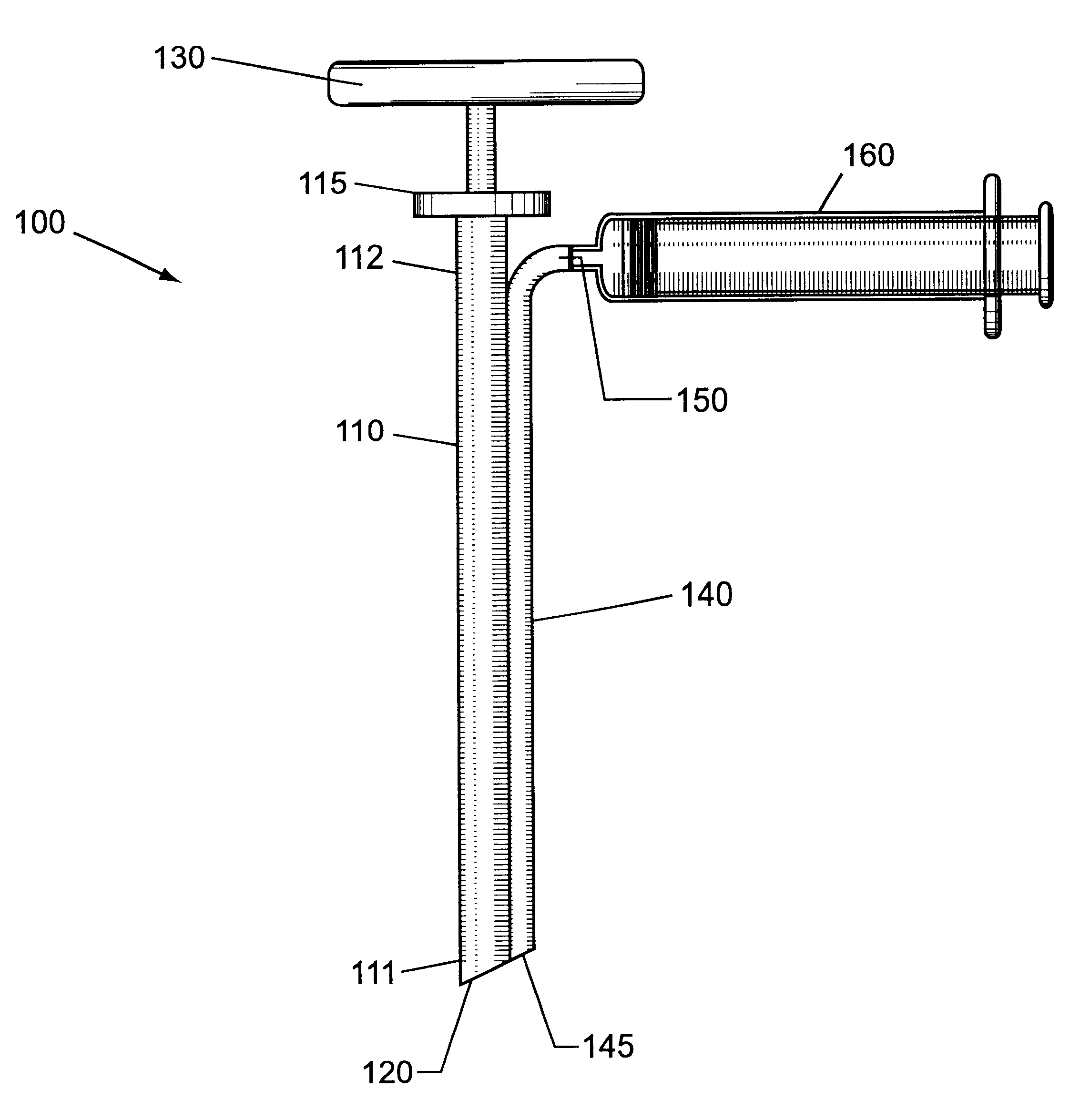 Devices and methods for extraction of bone marrow