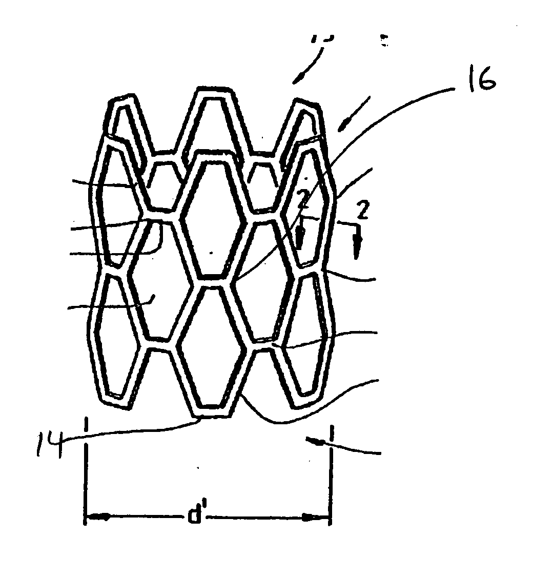 Polymer stent