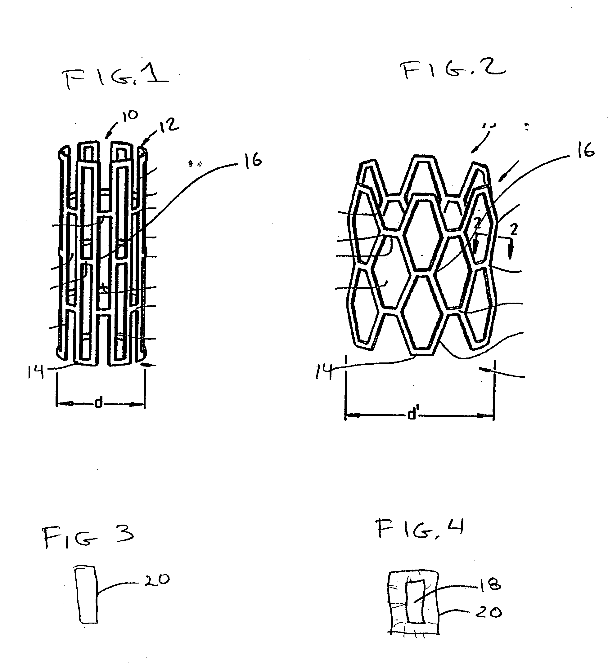 Polymer stent