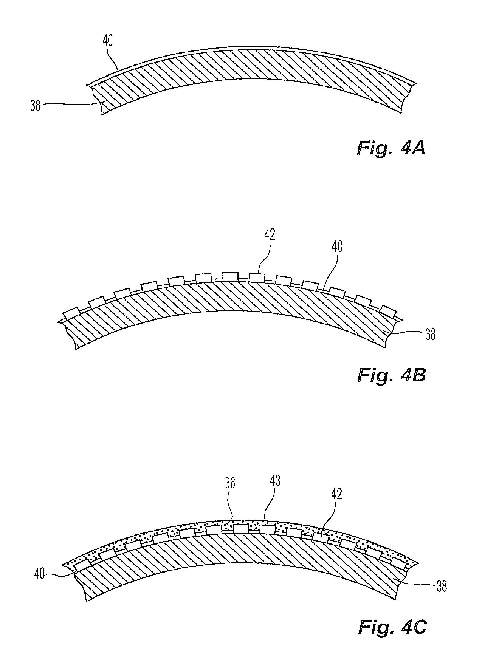 Balloon with radiopaque adhesive