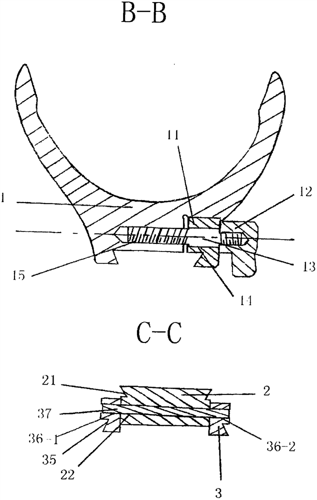 Anti-vibration replacement pin for lens