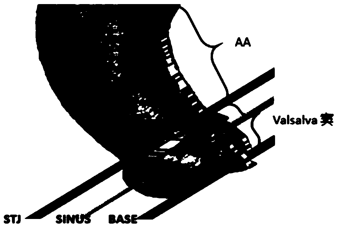 Aortic valve semi-automatic segmentation method based on CTA dynamic image