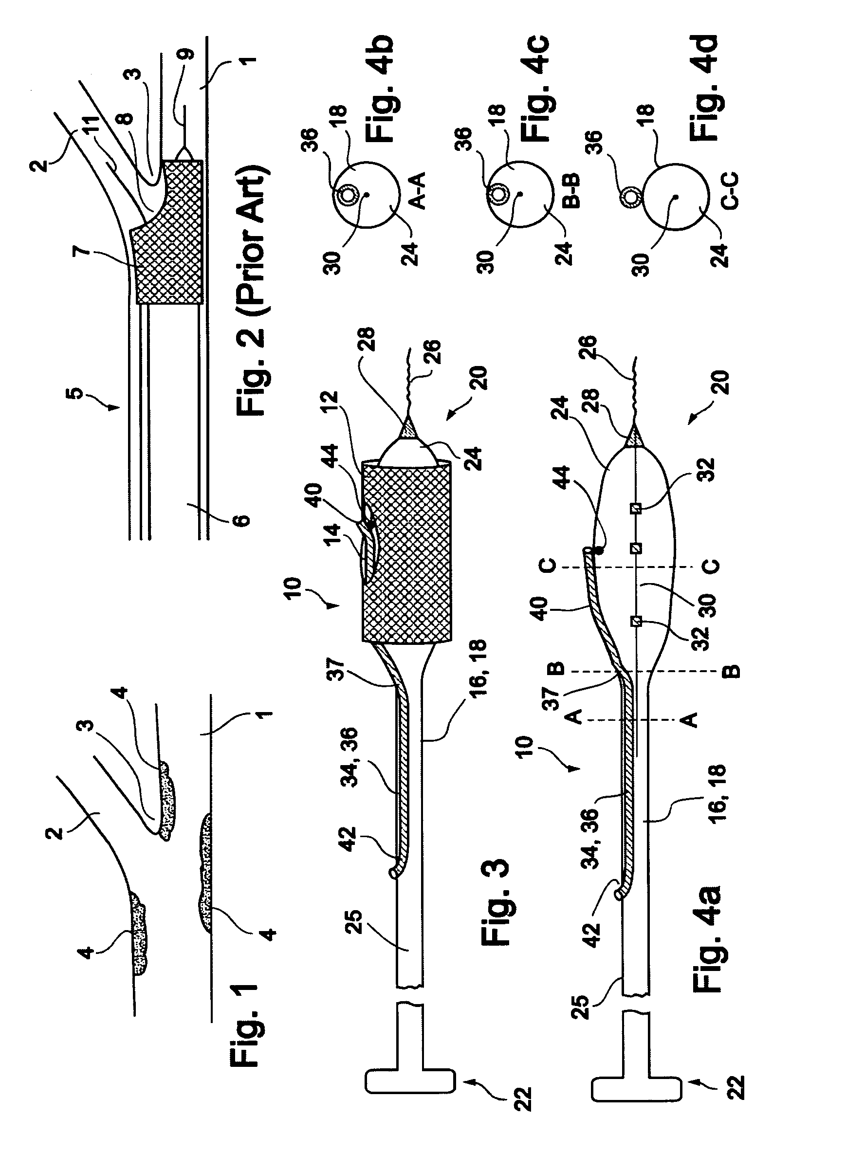 Vessel treatment devices