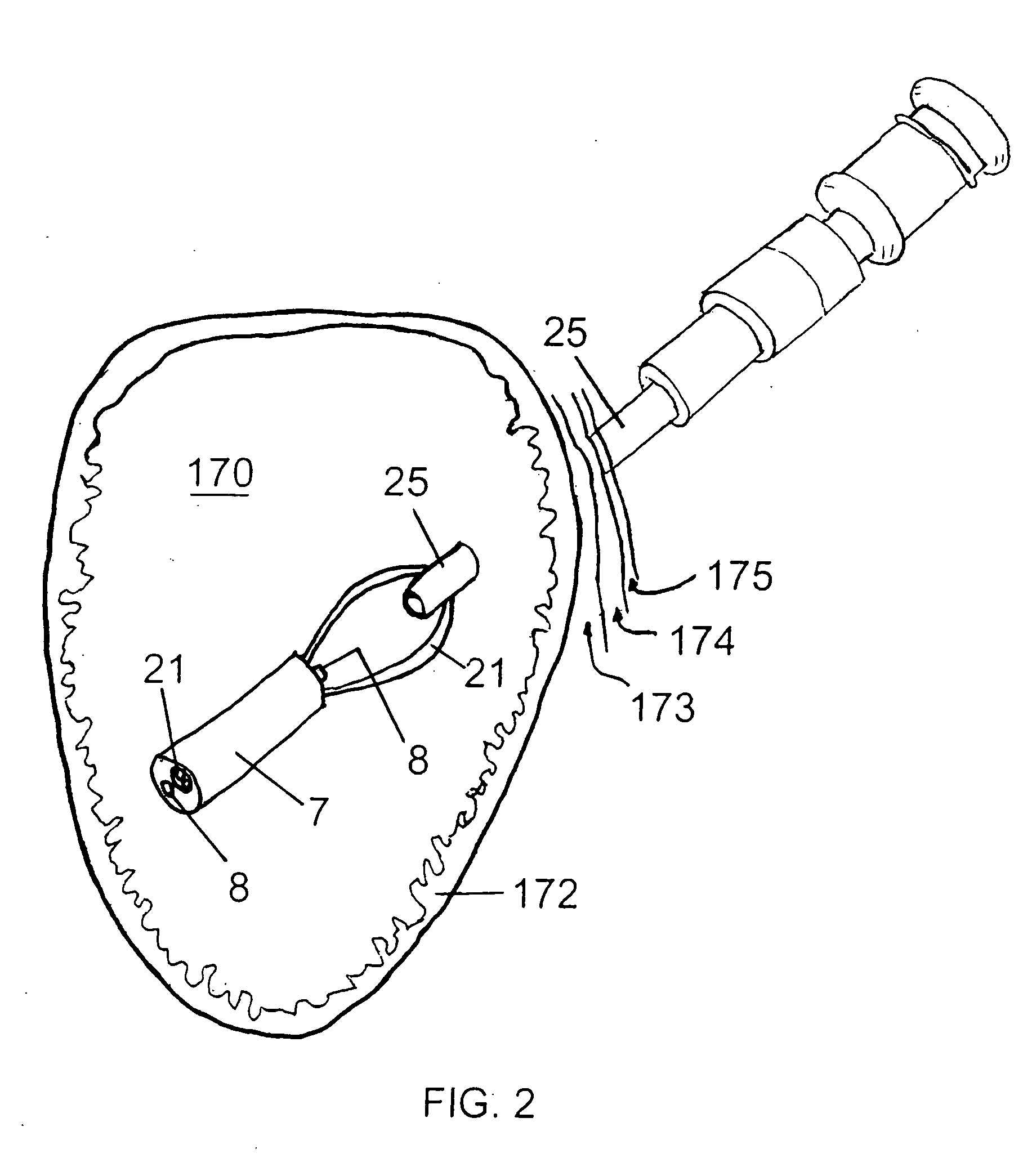 Feeding tube