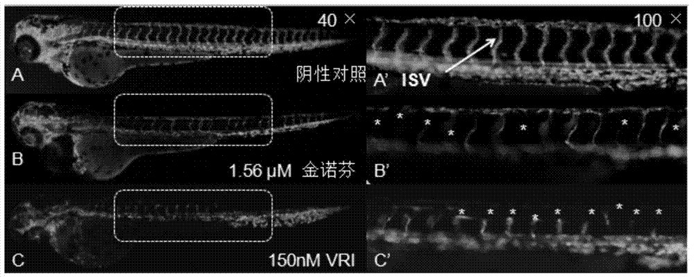 Application of auranofin to preparation of anti-angiogenic medicine