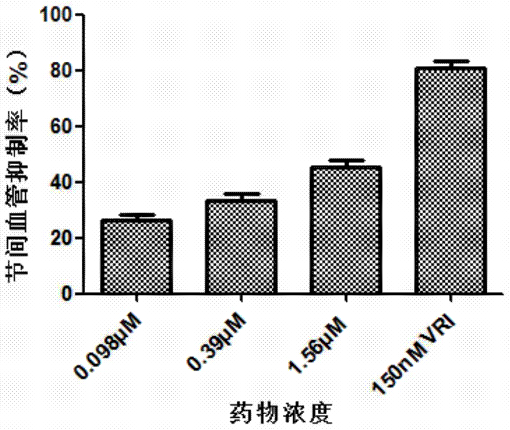 Application of auranofin to preparation of anti-angiogenic medicine