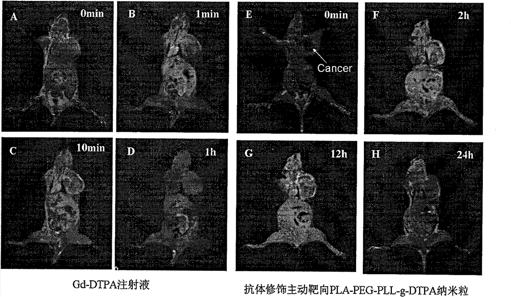 Active targeting polymer nanoparticle magnetic resonance contrast agent and preparation method thereof