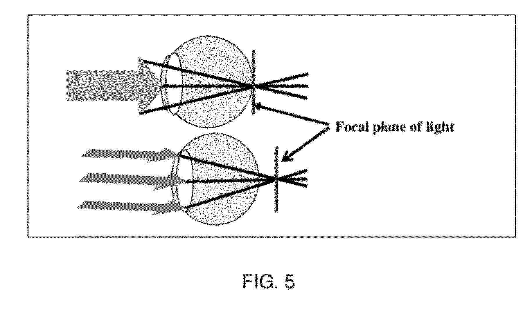 Method of Treating Ocular Disorders