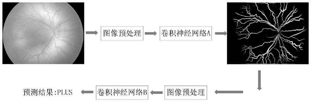 Classification of retinopathy of prematurity plus lesions