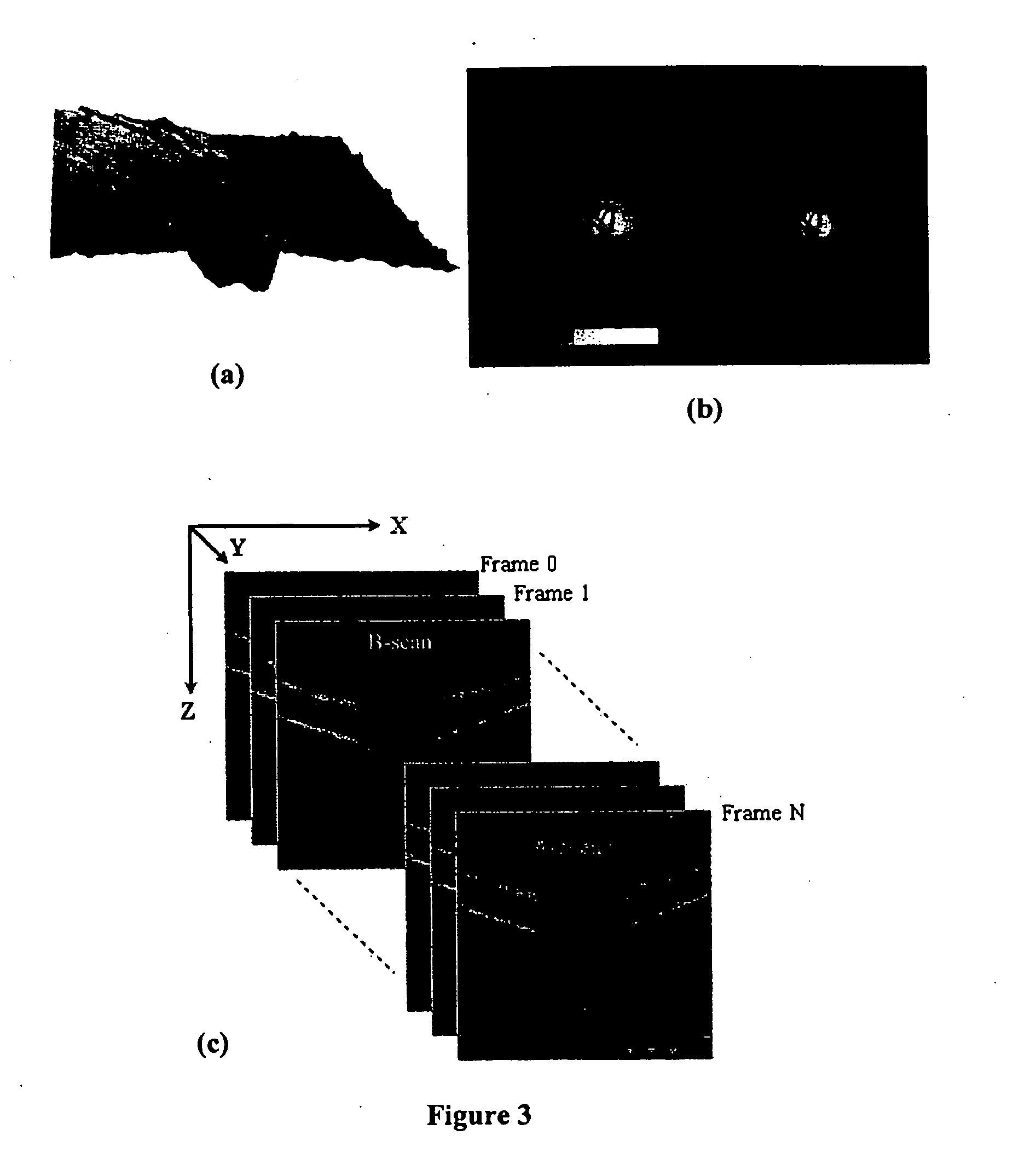 Automated assessment of optic nerve head with spectral domain optical coherence tomography