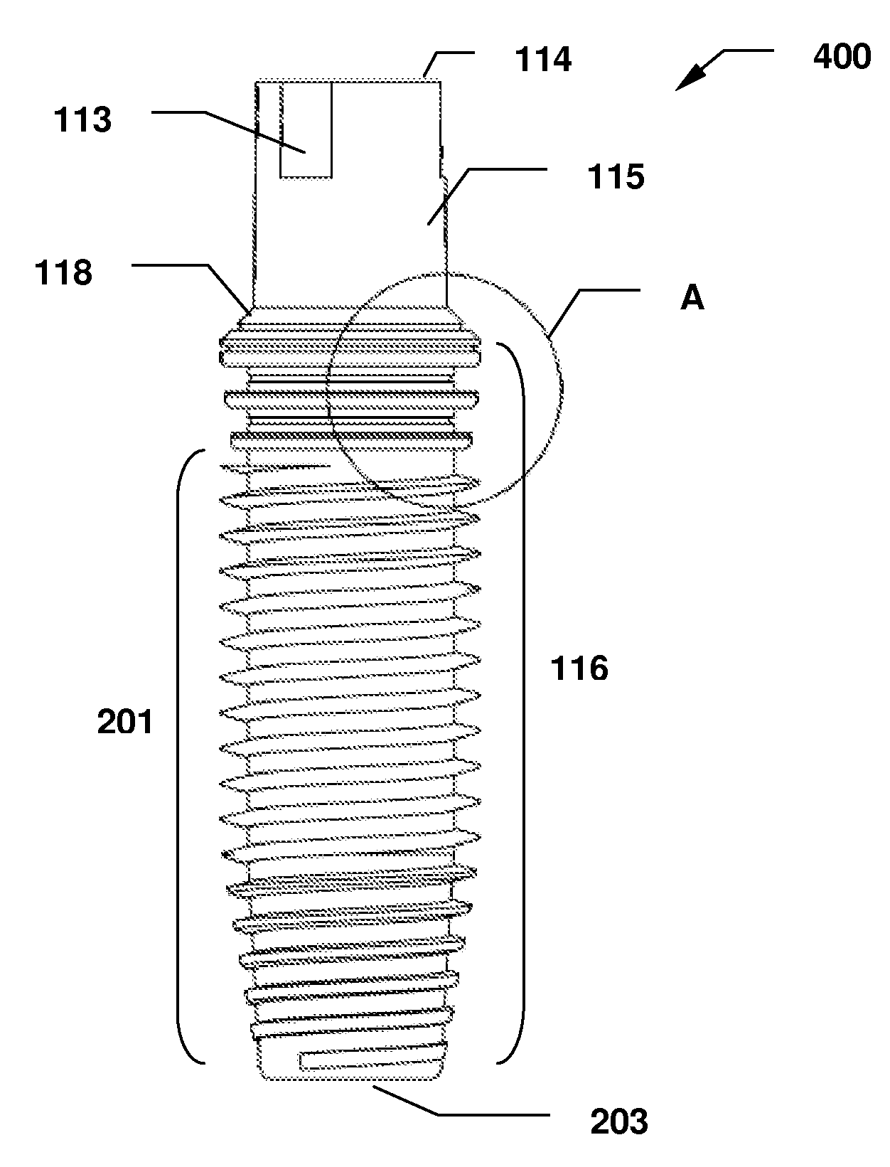 Dental Implant System and Method