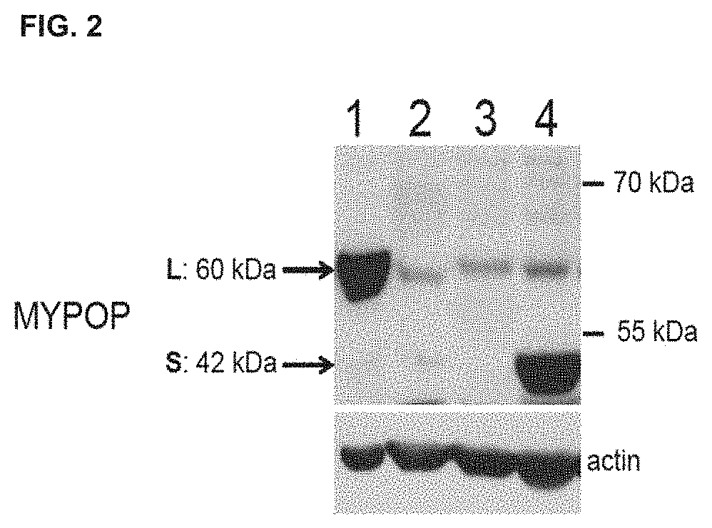 Myb-related transcription factor (MYPOP) as diagnostic marker and therapeutic target for tumor therapy