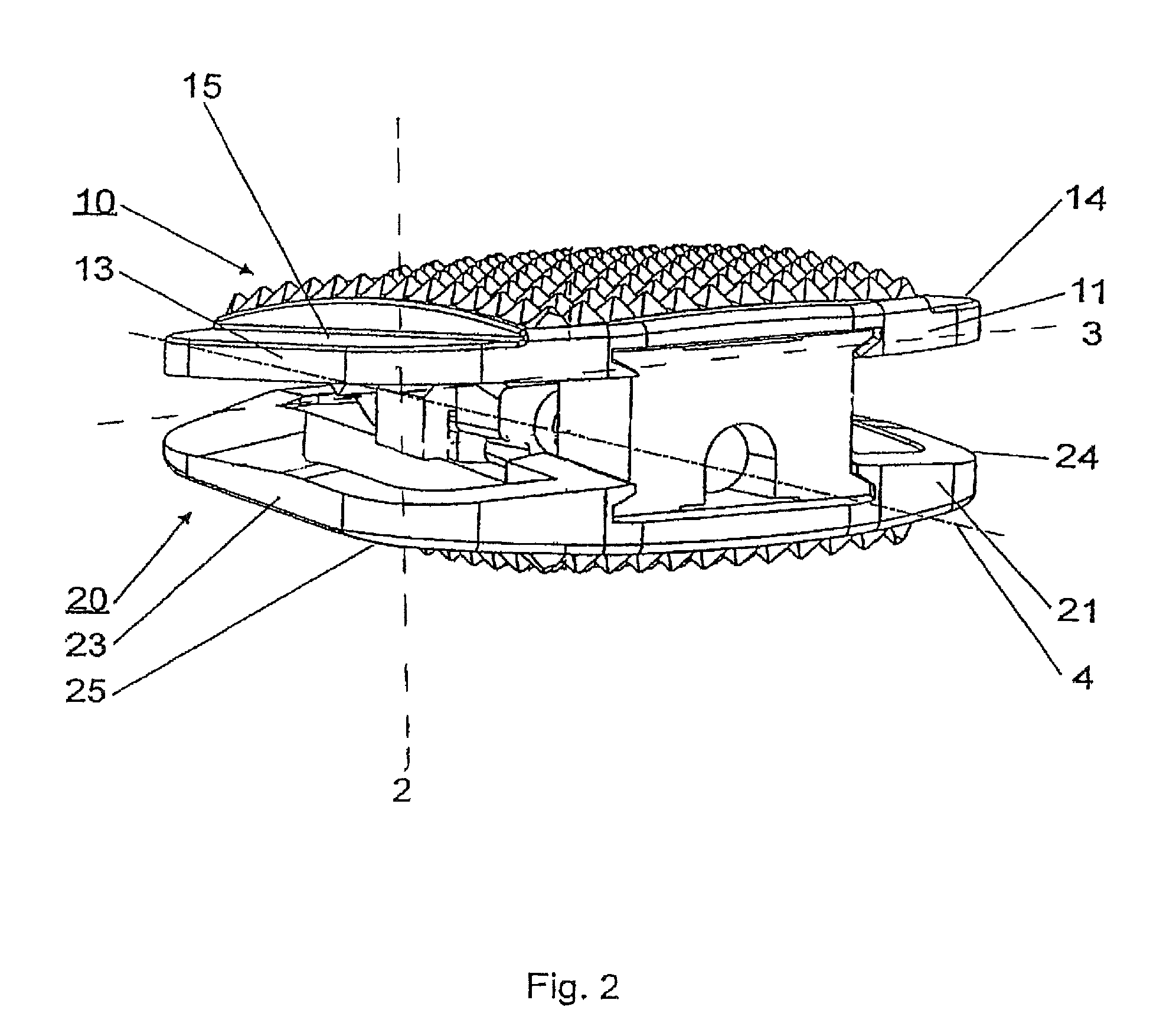 Intervertebral implant with tiltable joint parts