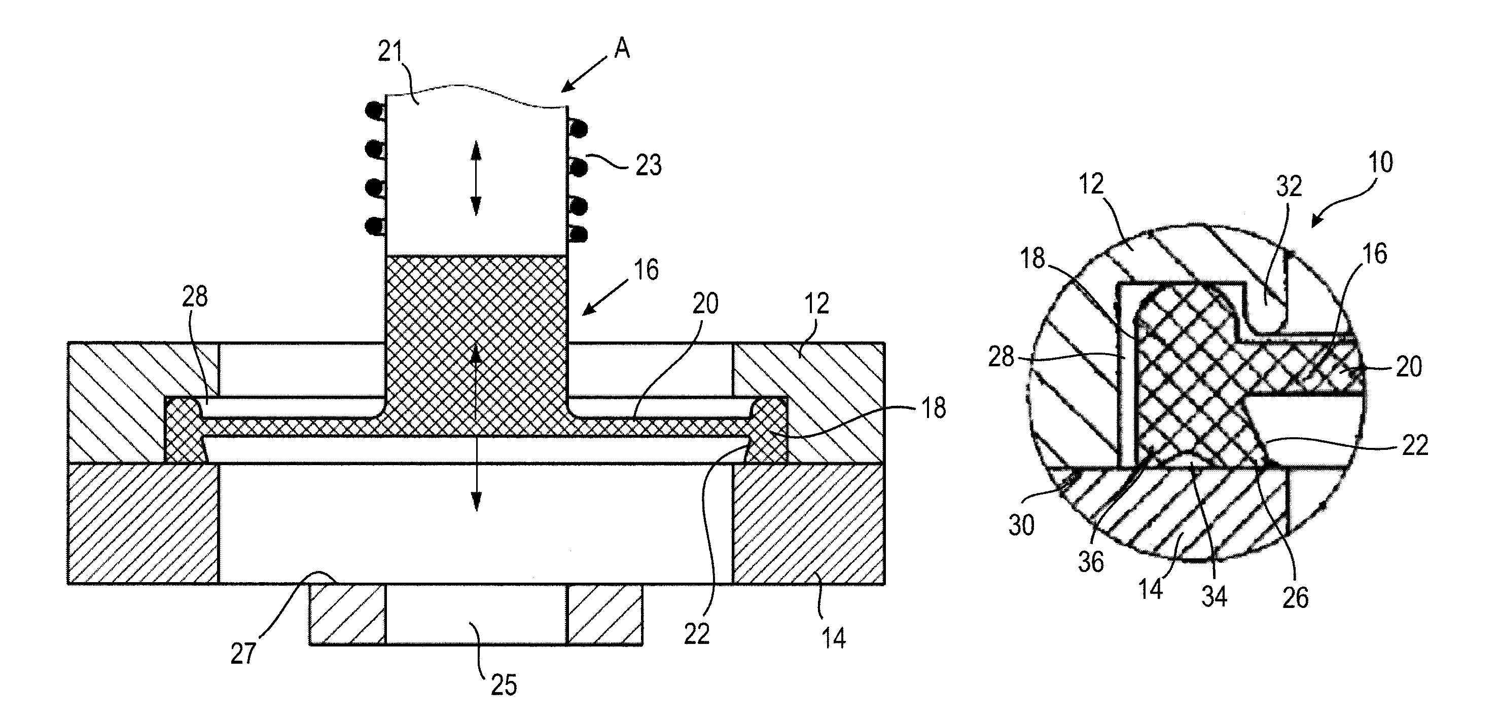 Membrane valve