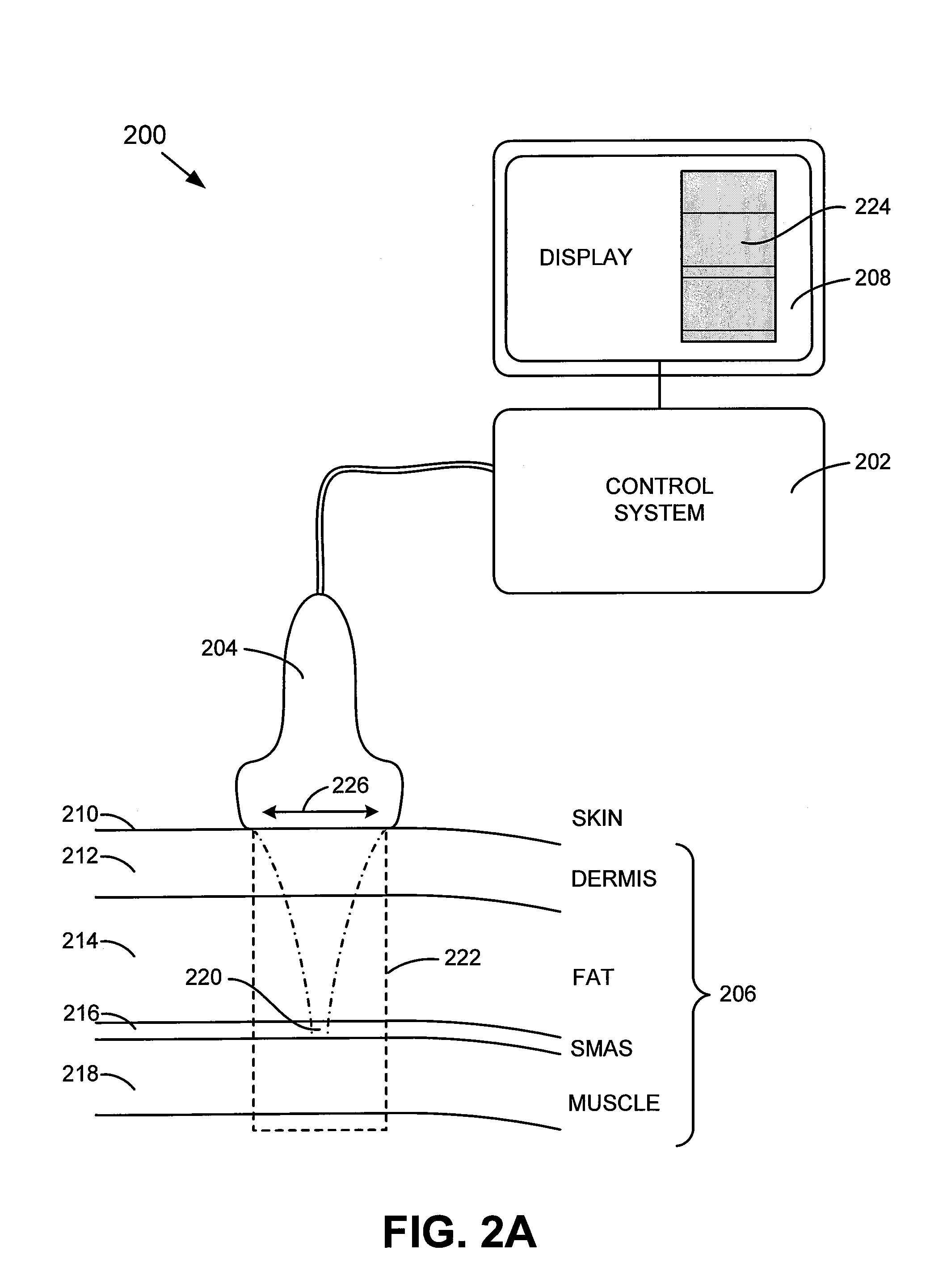 Method and system for noninvasive face lifts and deep tissue tightening