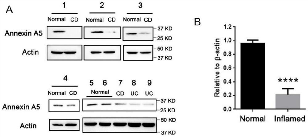 Application of phosphatidylserine in preparation of medicines for treating inflammatory bowel diseases