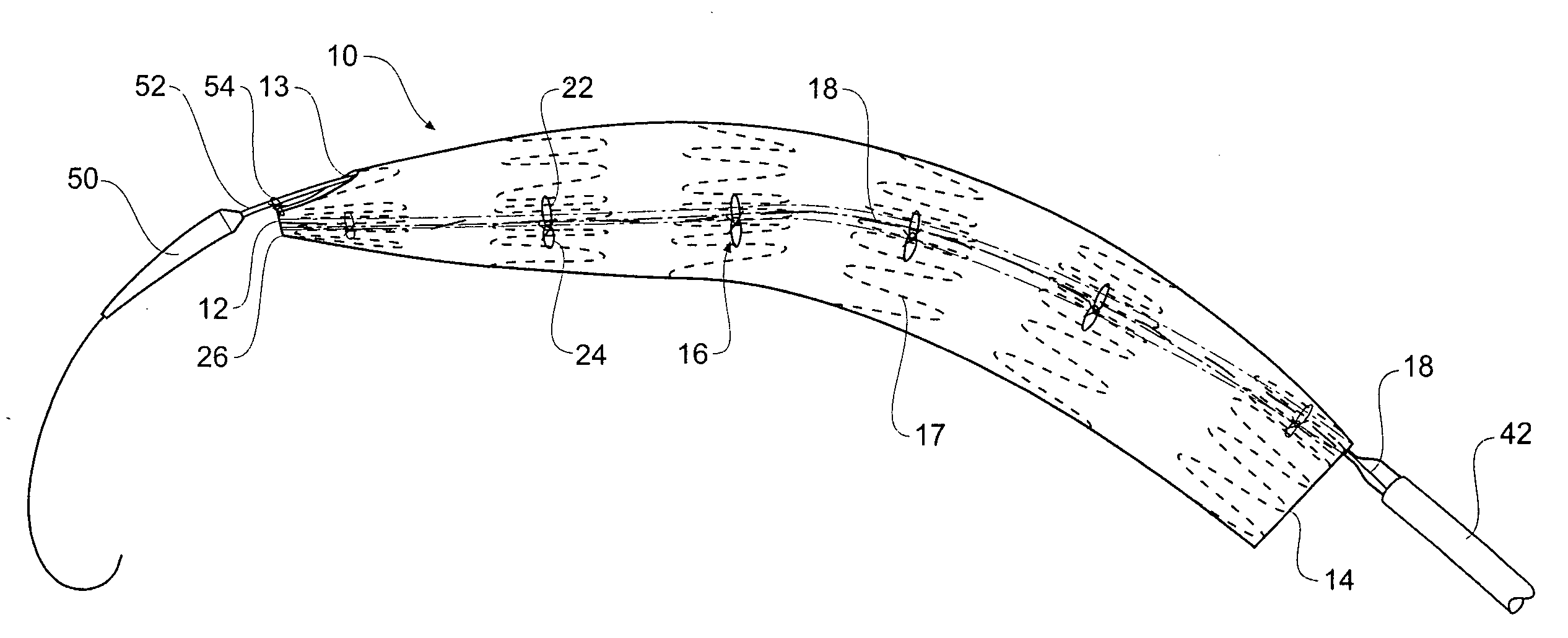 Stent grafts for the thoracic aorta