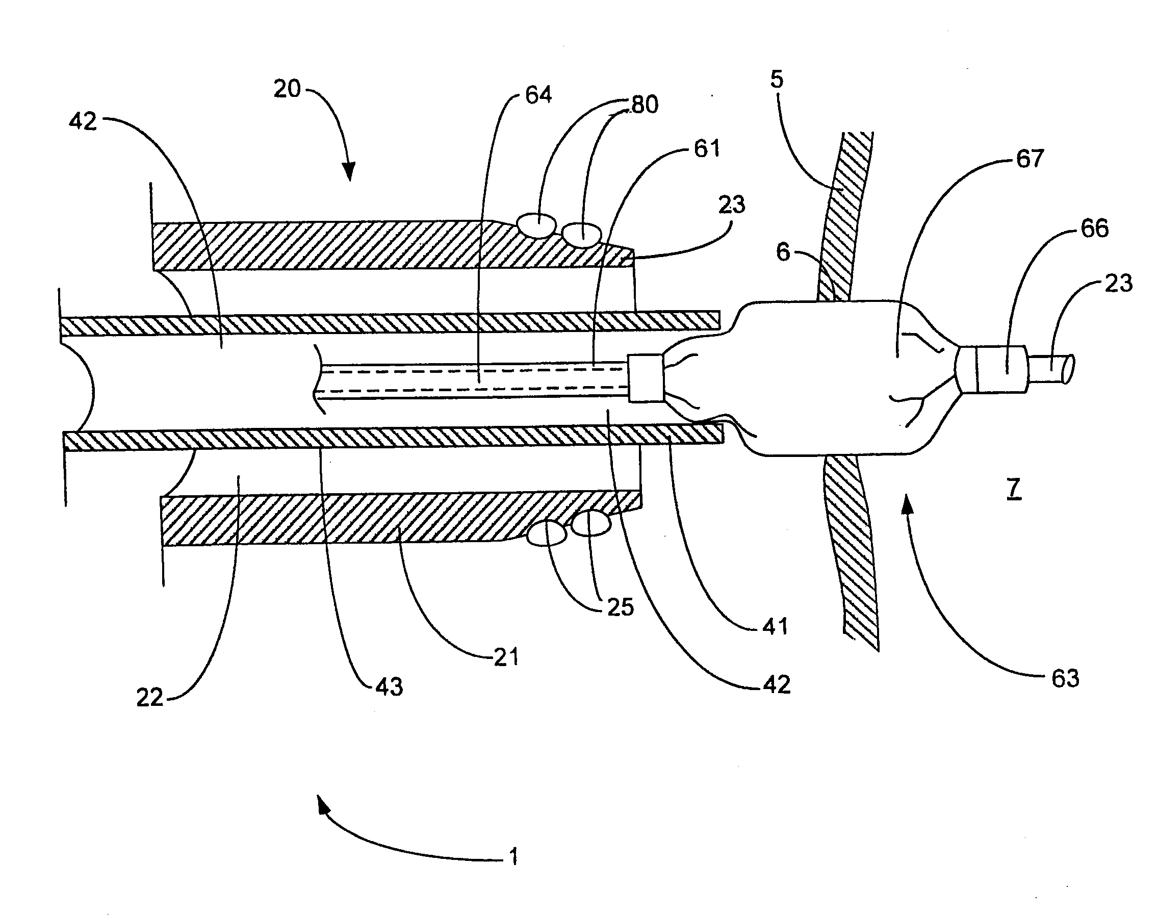 Tissue securing and sealing apparatus and related methods of use