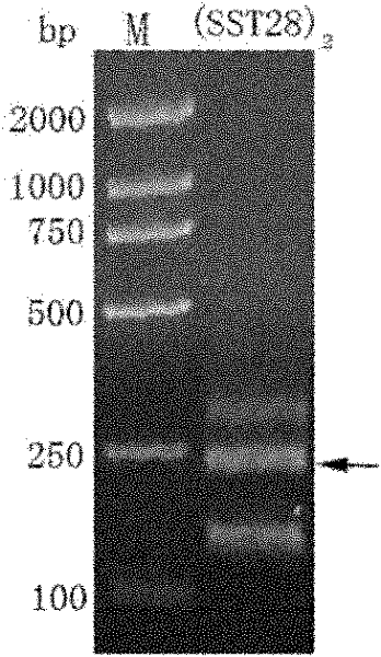 Fusion protein of human somatostatin 28 peptide and human serum albumin, encoding gene of fusion protein and preparation method for fusion protein